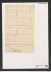 Aulacodiscus margaritaceus var. robustus Witt. (de-Toni-Nr.: Genus 182, Species 4515) Zeichnungen Sammlung Grunow (NHMW-BOT-W0377435)